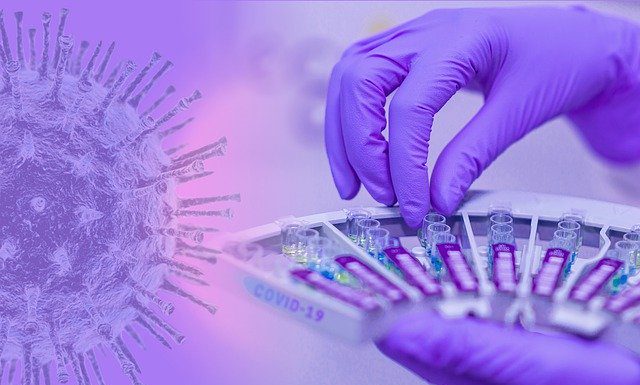 19 Corona-Fälle in Neustadt – ein weiterer Todesfall in der Region – insgesamt 1039 Corona-Fälle in der Region Hannover